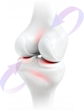 bone-sm