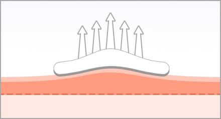 comparison-up_normal